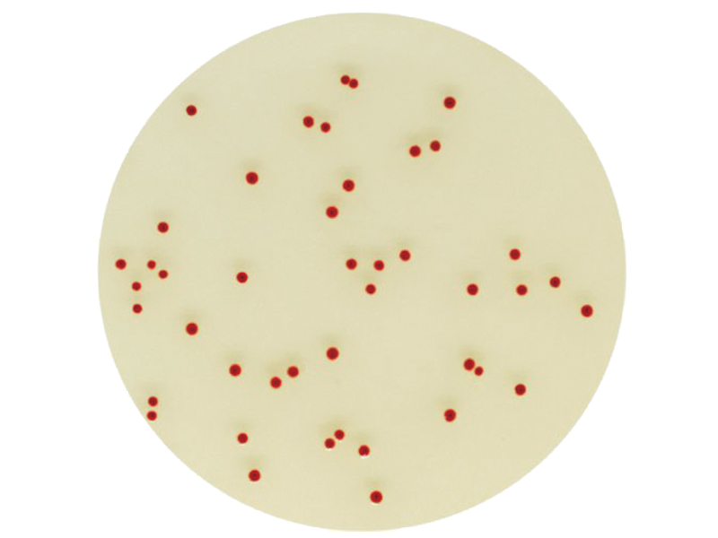 科瑪嘉 Campylobacter　　 / 科瑪嘉 彎曲桿菌